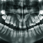 oral medicine and radiology